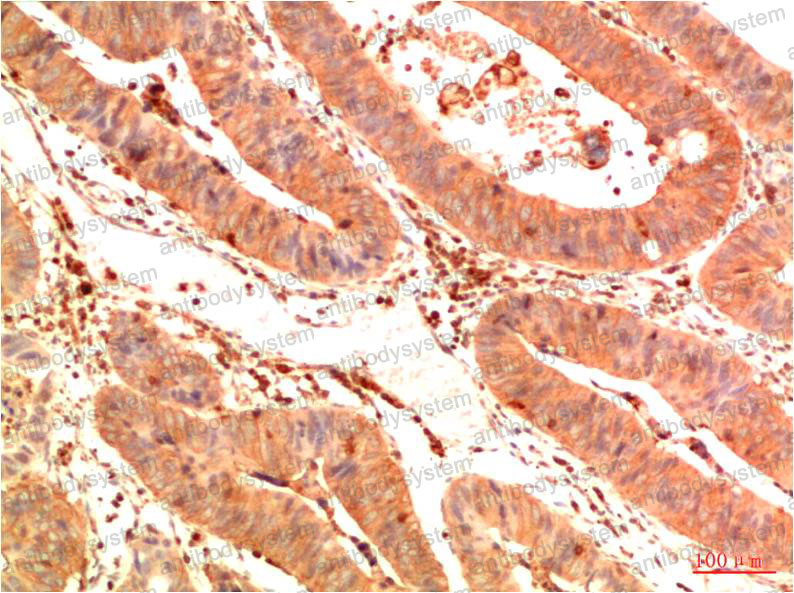 Anti-Acetyl-p53 (Lys382) Antibody (R2Y83)