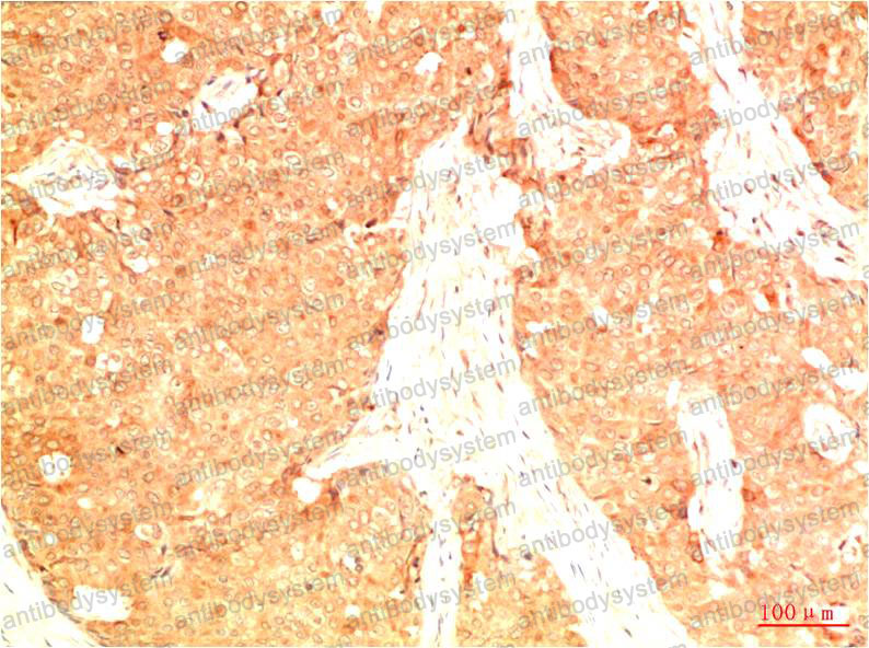 Anti-Acetyl-p53 (Lys382) Antibody (R2Y84)