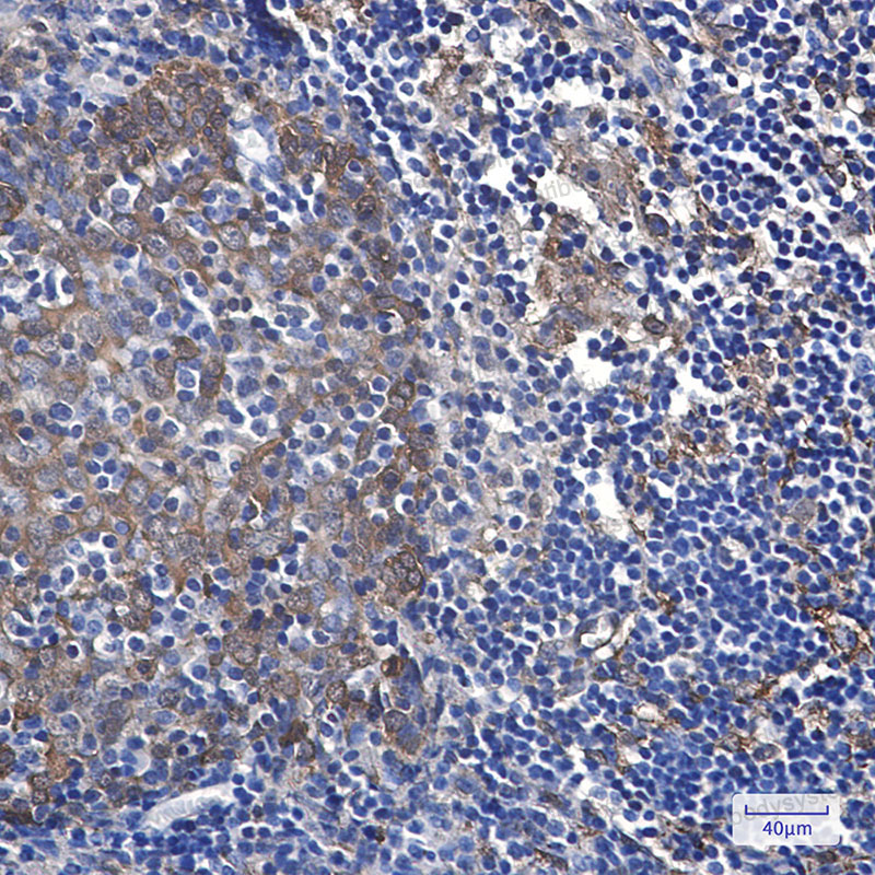 Anti-HSPB1/HSP27 Antibody (R1J73)