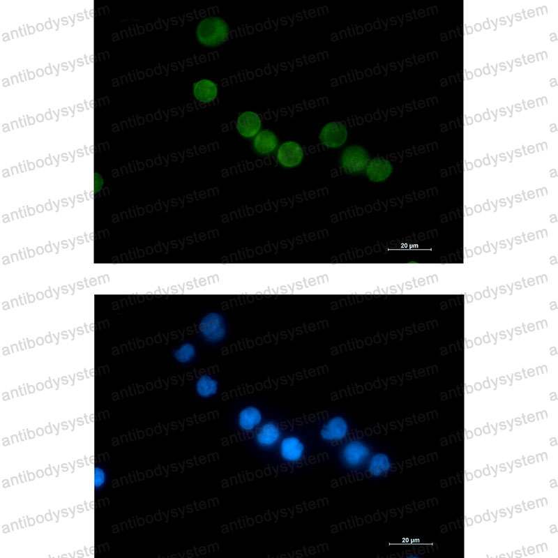 Anti-TYMS Antibody (R1J75)