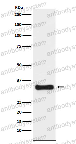 Anti-TYMS Antibody (R1J74)