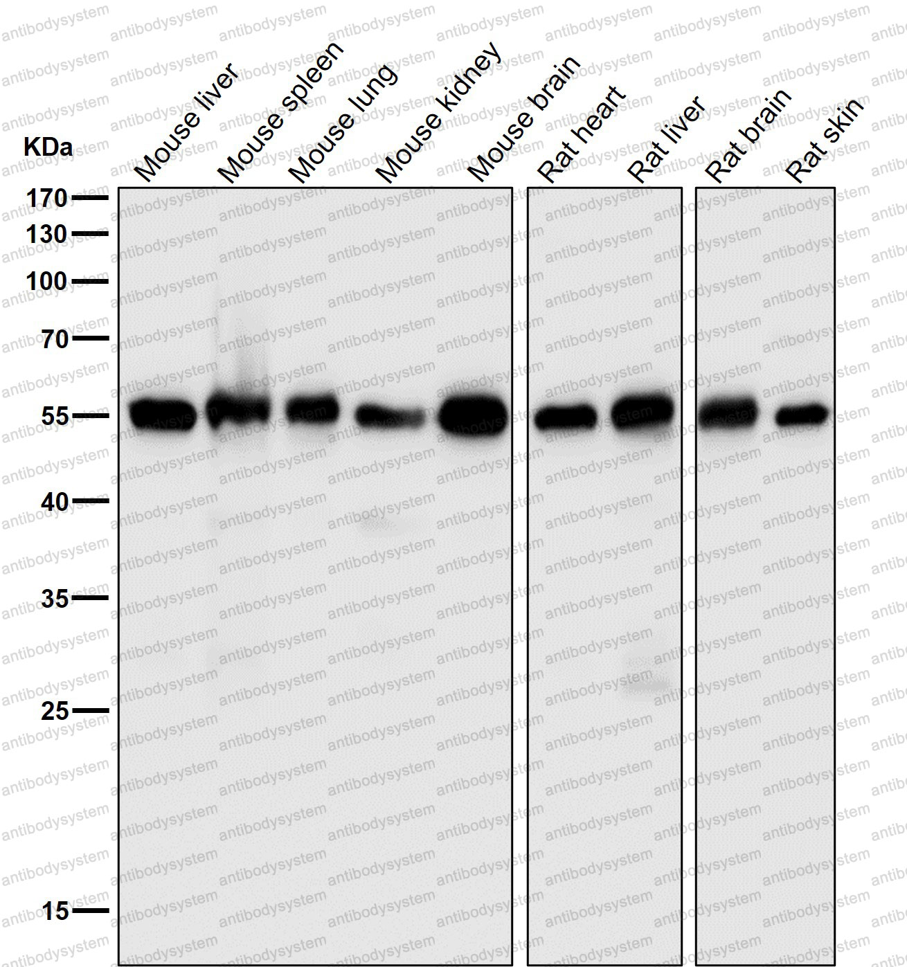 Anti-CYBB/NOX2 Antibody (R1J76)