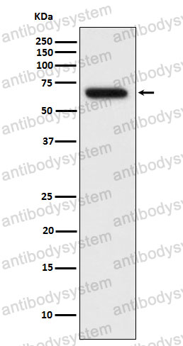 Anti-RPN1 Antibody (R1J77)