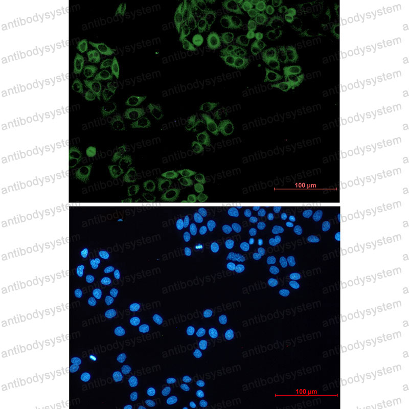 Anti-GNAI2 Antibody (R1J79)