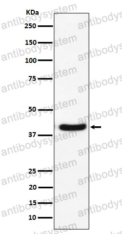 Anti-GNAI2 Antibody (R1J78)