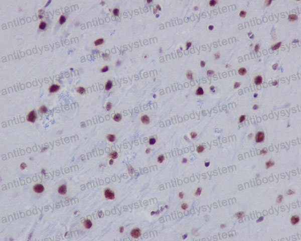 Anti-Histone H2A (acetyl K9) Antibody (R1B99)