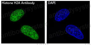 Anti-Histone H2A Antibody (R1C08)