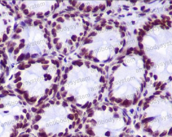 Anti-Histone H2A (hydroxyl Y39) Antibody (R1C02)
