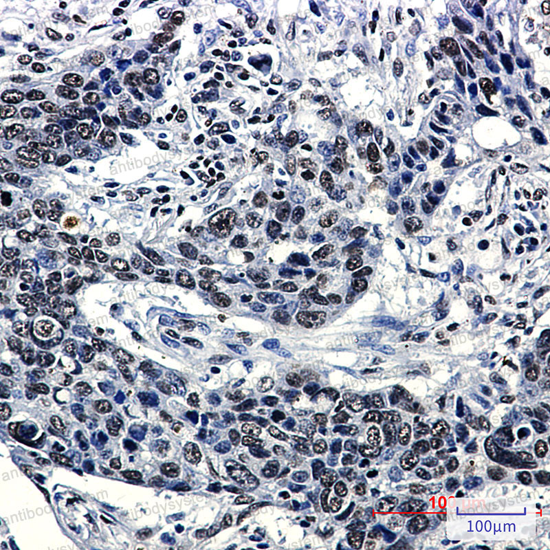 Anti-Hydroxyl-Histone H2A (Tyr39) Antibody (R1J81)