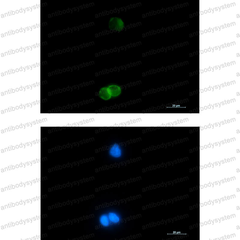 Anti-CD236/GYPC Antibody (R1J84)