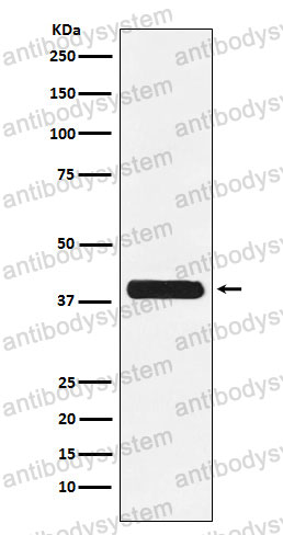 Anti-CD236/GYPC Antibody (R1J83)