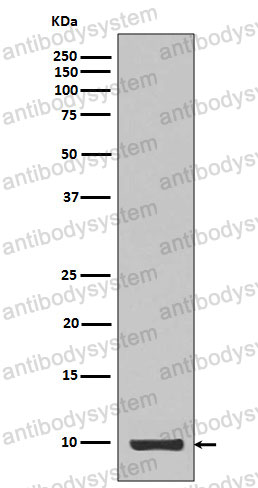 Anti-IGF1 Antibody (R1B65)