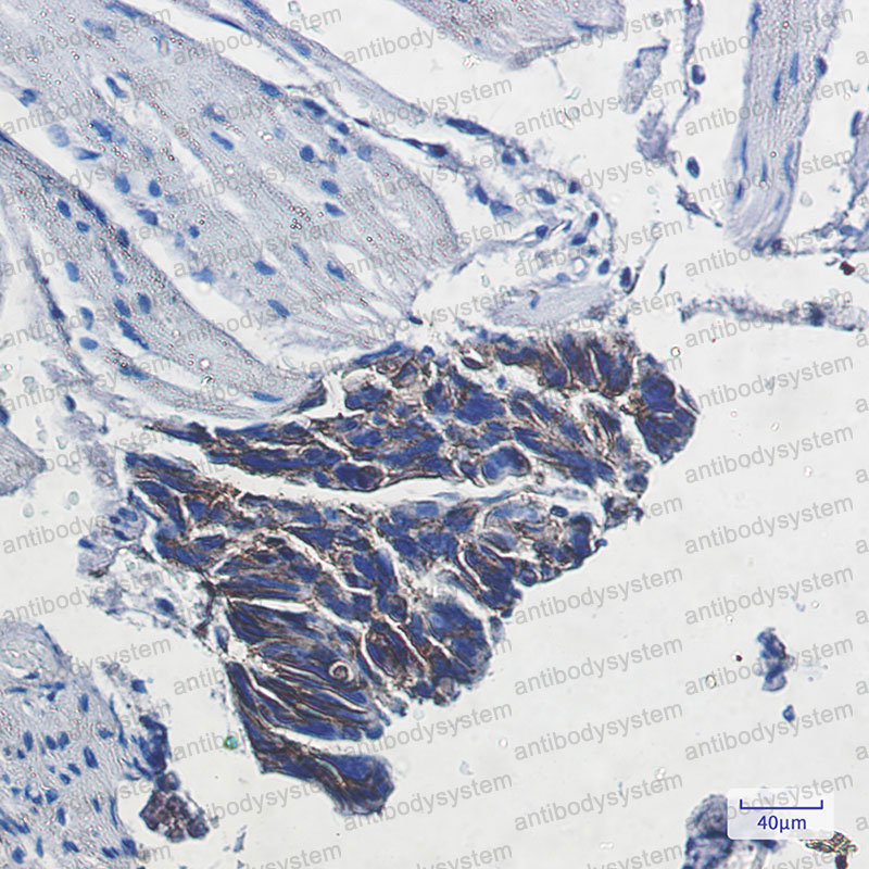 Anti-ATP1B1 Antibody (R1J86)