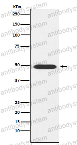 Anti-ATP1B1 Antibody (R1J85)