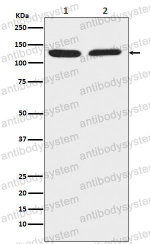 Anti-CHGB Antibody (R1J87)