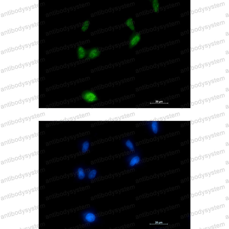 Anti-Phospho-APP (Thr743) Antibody (R1J88)