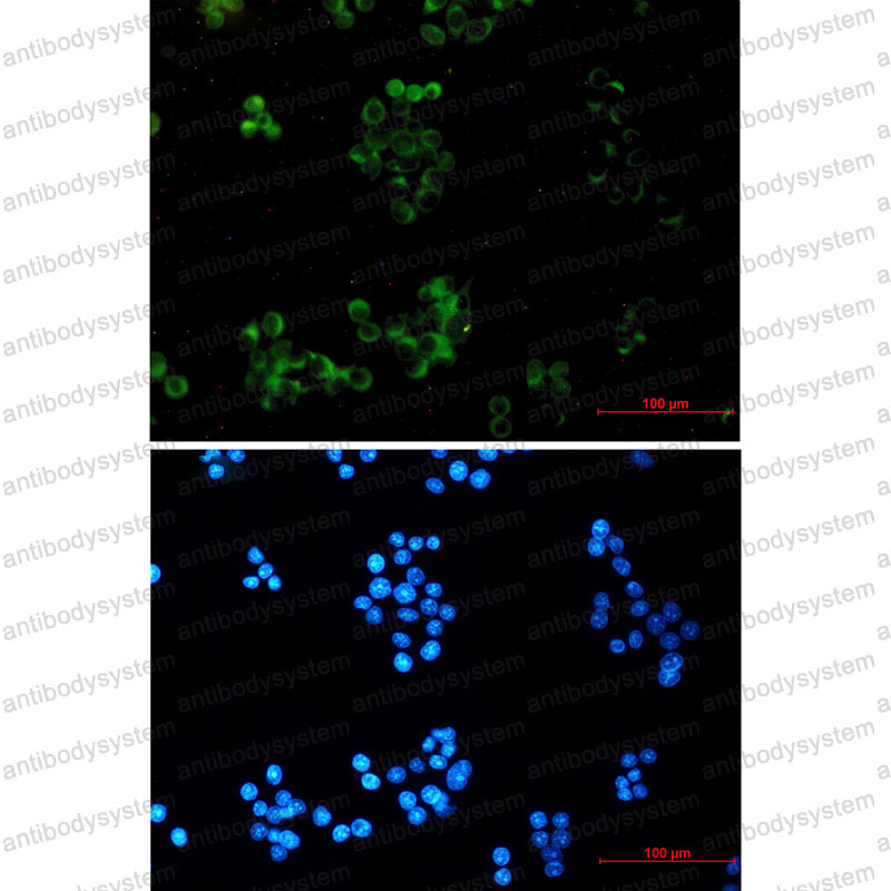 Anti-APP Antibody (R1J89)
