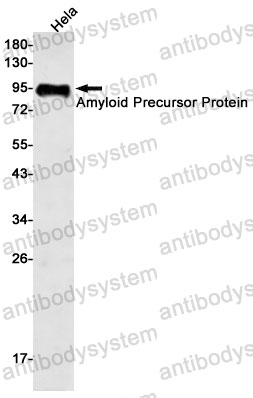 Anti-APP Antibody (R1J91)