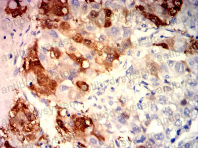 Immunohistochemical for Anti-ARG1/Arginase-1 Antibody (R2Y98) ?>