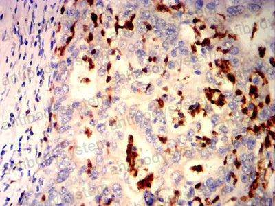 Immunohistochemical for Anti-ARG1/Arginase-1 Antibody (R2Y98) ?>
