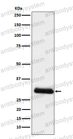 Anti-APOD Antibody (R1J93)
