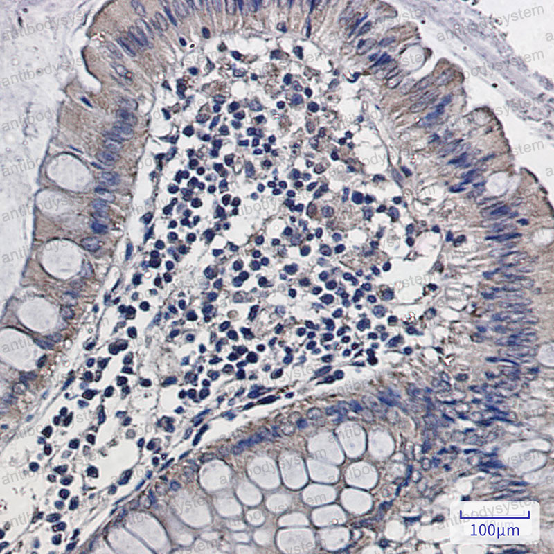 Anti-ALDH2 Antibody (R1J94)