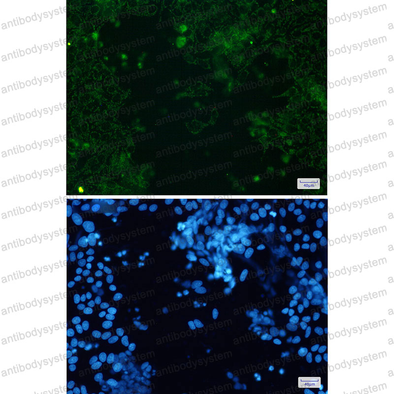 Anti-CYP17A1 Antibody (R1J96)