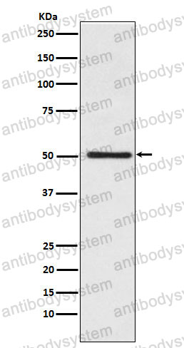 Anti-CYP17A1 Antibody (R1J95)