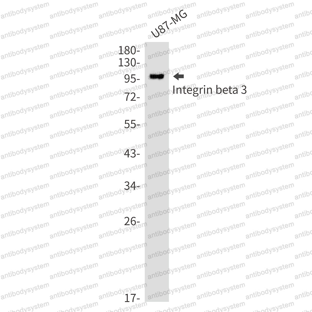 Anti-CD61/ITGB3 Antibody (R1J97)