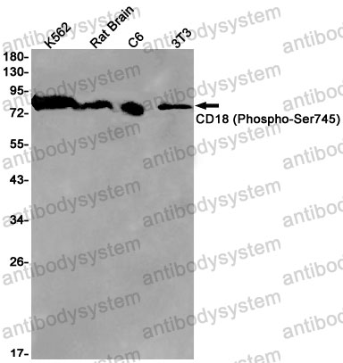 Anti-Phospho-CD18/ITGB2 (Ser745) Antibody (R1J98)