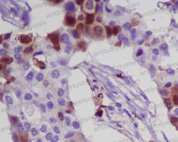 Anti-S100A8/MRP8 Antibody (R1B35)