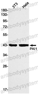 Anti-SERPINE1/PAI-1 Antibody (R1K02)