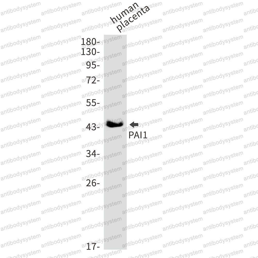 Anti-SERPINE1/PAI-1 Antibody (R1K03)