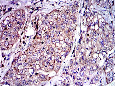 Immunohistochemical for Anti-SERPINE1/PAI-1 Antibody (R2Z08) ?>