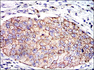 Immunohistochemical for Anti-SERPINE1/PAI-1 Antibody (R2Z08) ?>