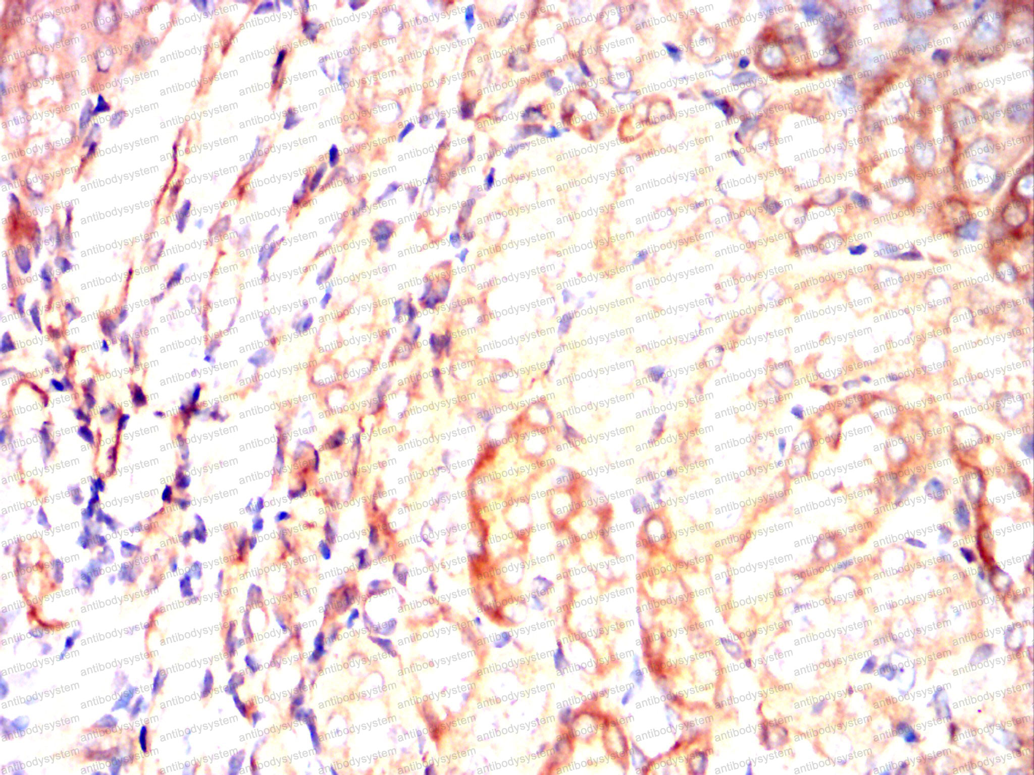 Immunohistochemical for Anti-SERPINE1/PAI-1 Antibody (R2Z08) ?>