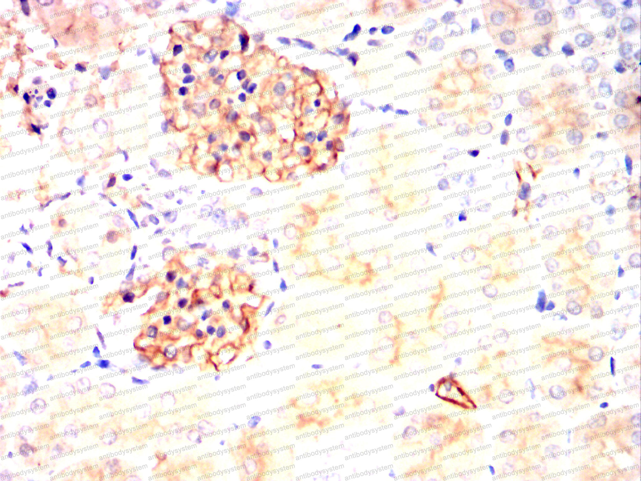 Immunohistochemical for Anti-SERPINE1/PAI-1 Antibody (R2Z08) ?>