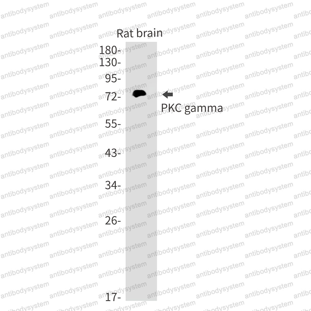 Anti-PRKCG Antibody (R1K08)
