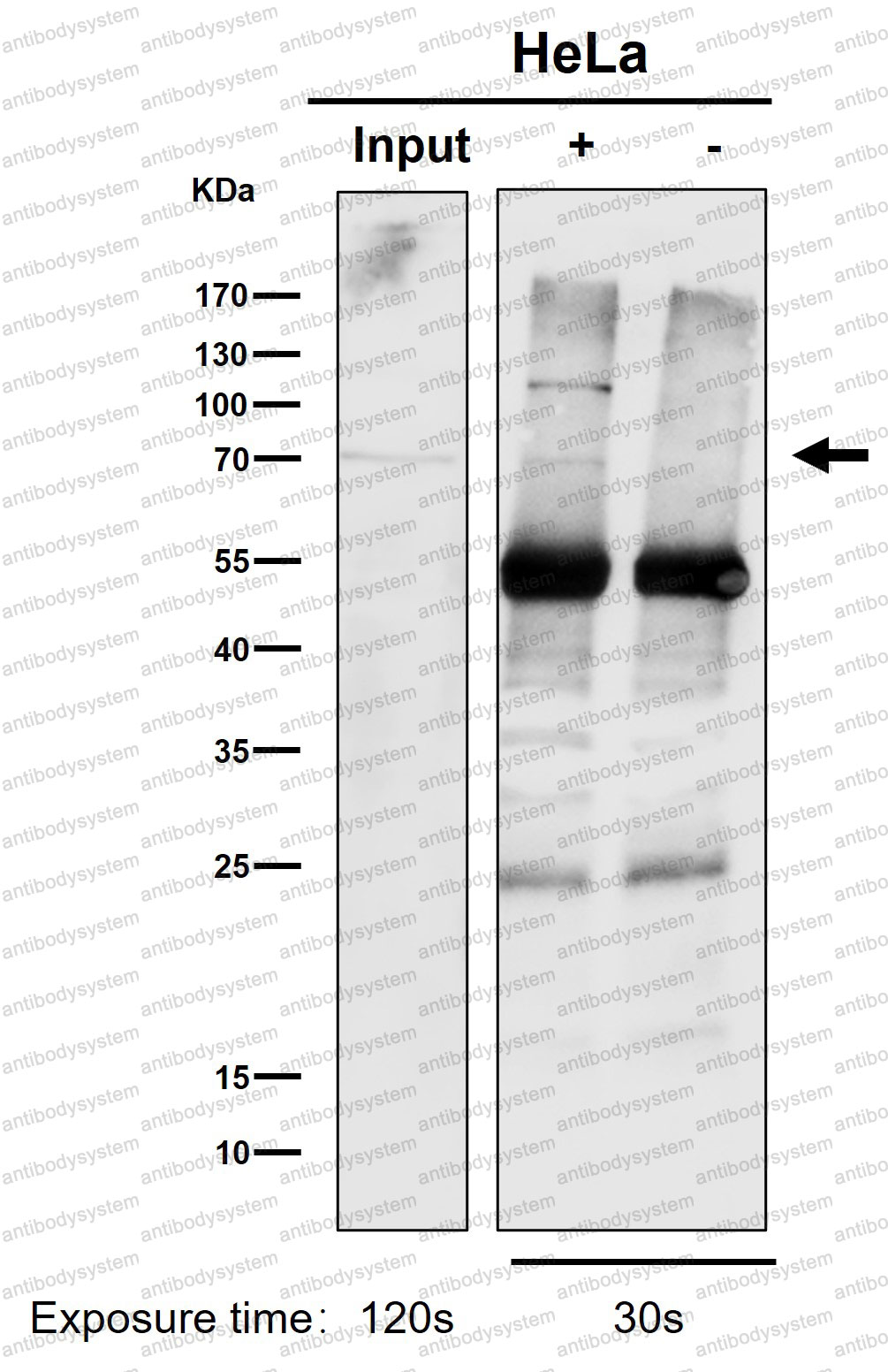 Anti-PKC Antibody (R1K04)