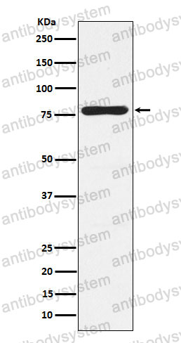 Anti-PRKCG Antibody (R1K05)