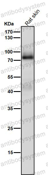 Anti-PRKCG Antibody (R1K06)