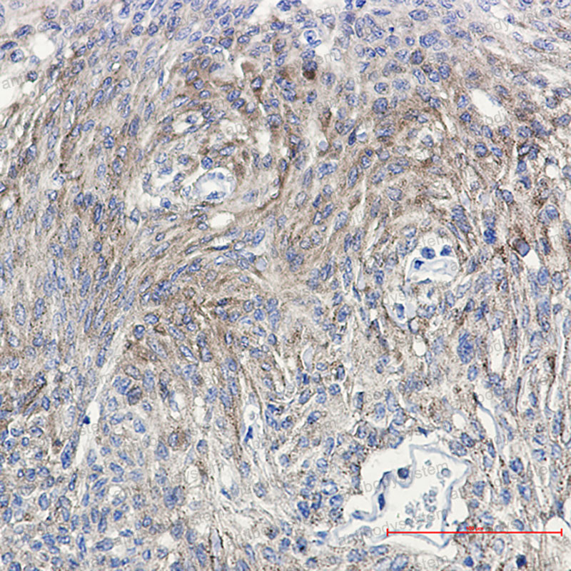 Anti-Phospho-PRKCG (Thr514) Antibody (R1K07)