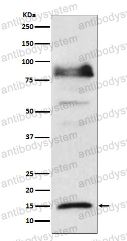 Anti-ISG15 Antibody (R1K10)