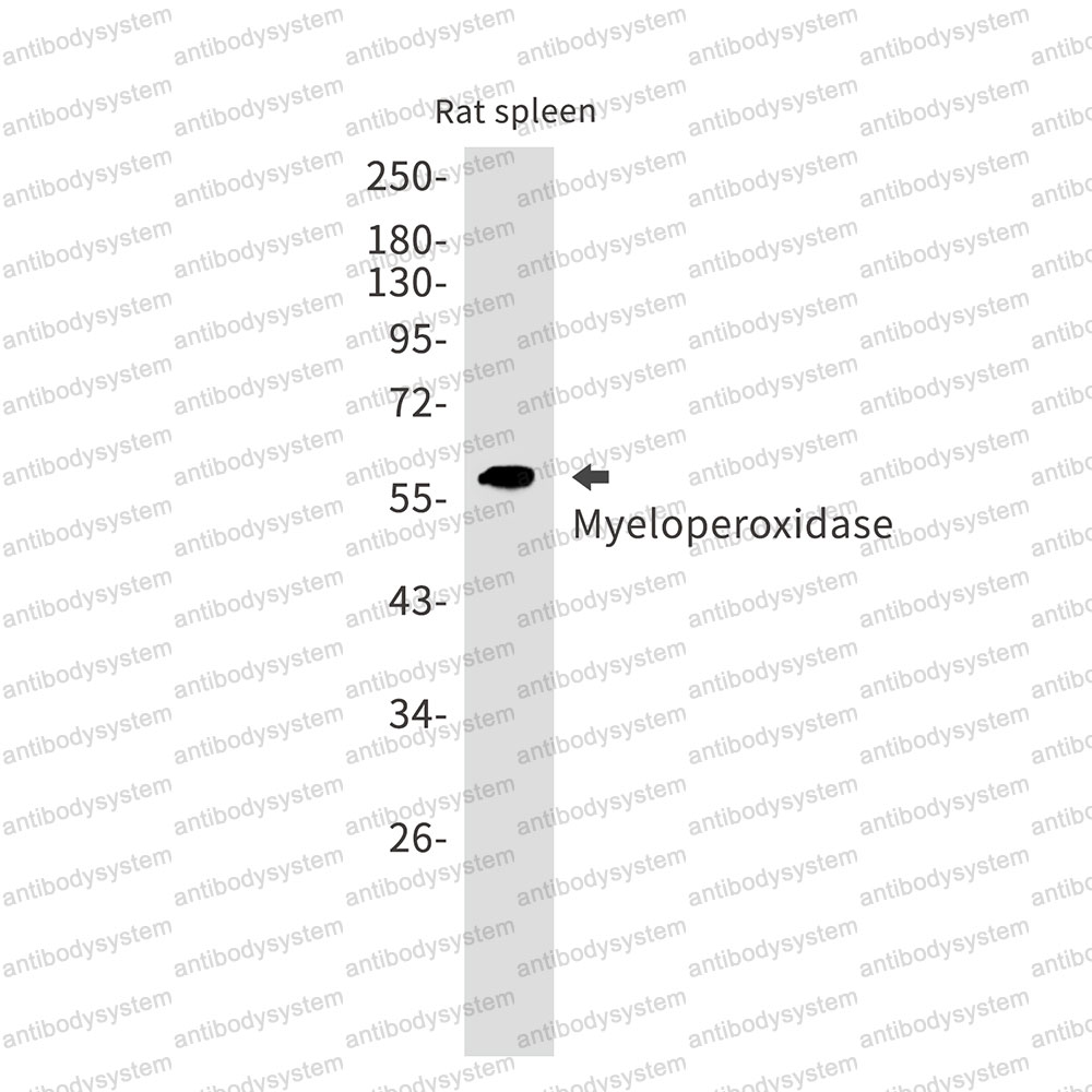 Anti-MPO/Myeloperoxidase Antibody (R1K14)