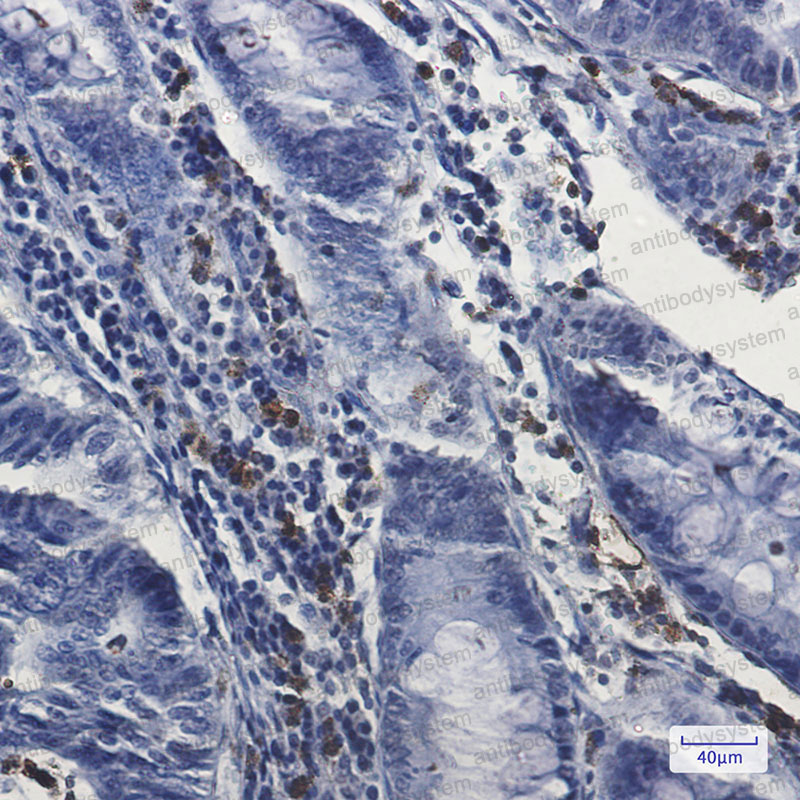 Anti-MPO/Myeloperoxidase Antibody (R1K13)