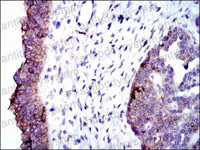 Immunohistochemical for Anti-ALPL Antibody (R2Z11) ?>