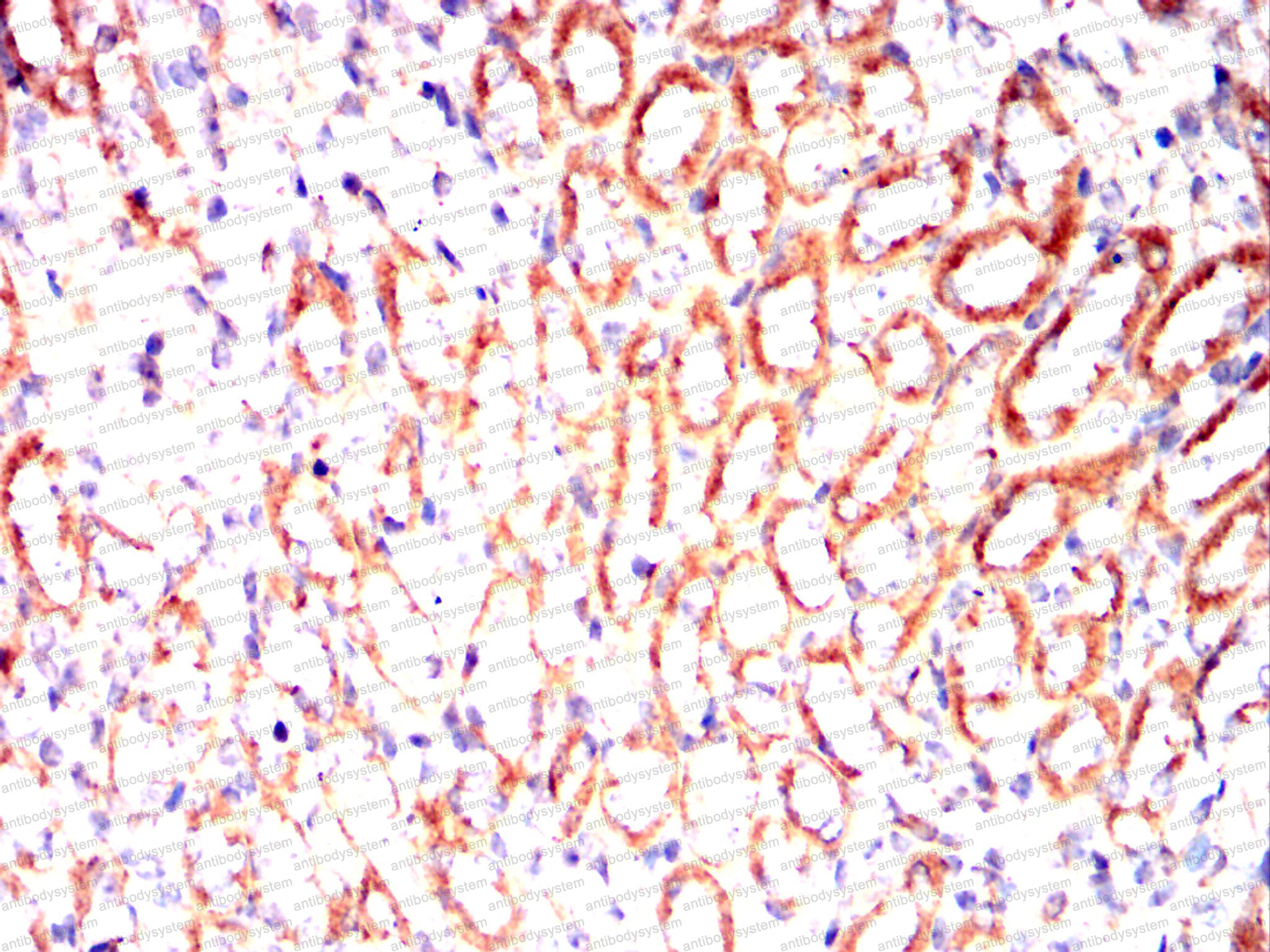 Immunohistochemical for Anti-ALPL Antibody (R2Z11) ?>