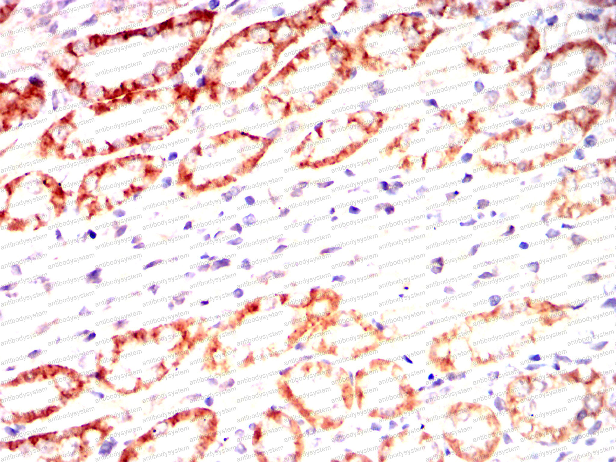 Immunohistochemical for Anti-ALPL Antibody (R2Z11) ?>