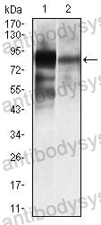 Western blot for Anti-ALPL Antibody (R2Z11) ?>