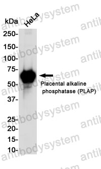 Anti-ALPP/PLAP Antibody (R1K18)